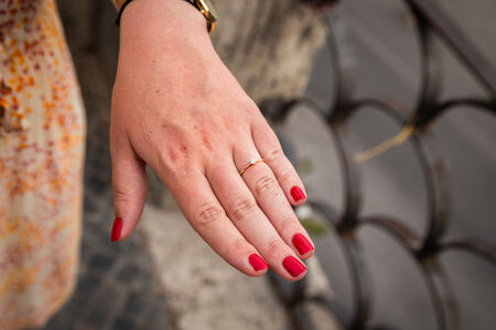 A detail of the ring during a proposal photo session at the Pincio Gardens in Rome